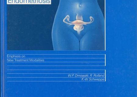 Endometriosis Emphasis on New Treatment Modalities,1989