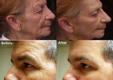 Epilift Instant Face Lift Serum Epilift Instant Face Lift Serum