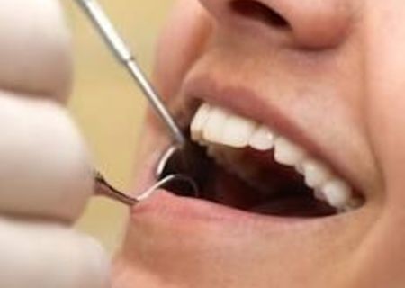 NOIEMBRIE PRETURI MICI CAB. DENTAR NOIEMBRIE PRETURI MICI CAB. DENTAR