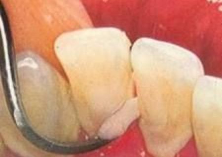 Stomatologie la preturi avantajoase Stomatologie la preturi avantajoase