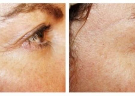 Tratament facial cu produse naturale