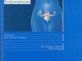 Endometriosis Emphasis on New Treatment Modalities,1989